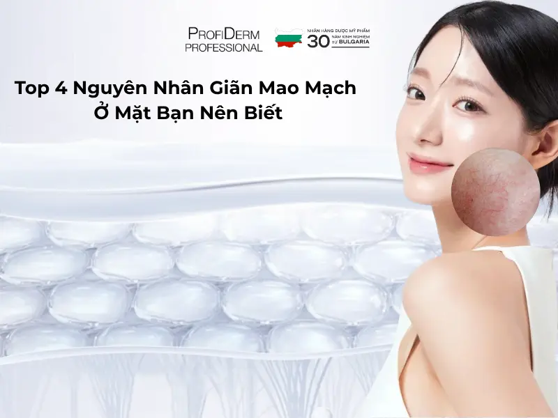 nguyên nhân giãn mao mạch ở mặt nguyên nhân giãn mao mạch ở mặt