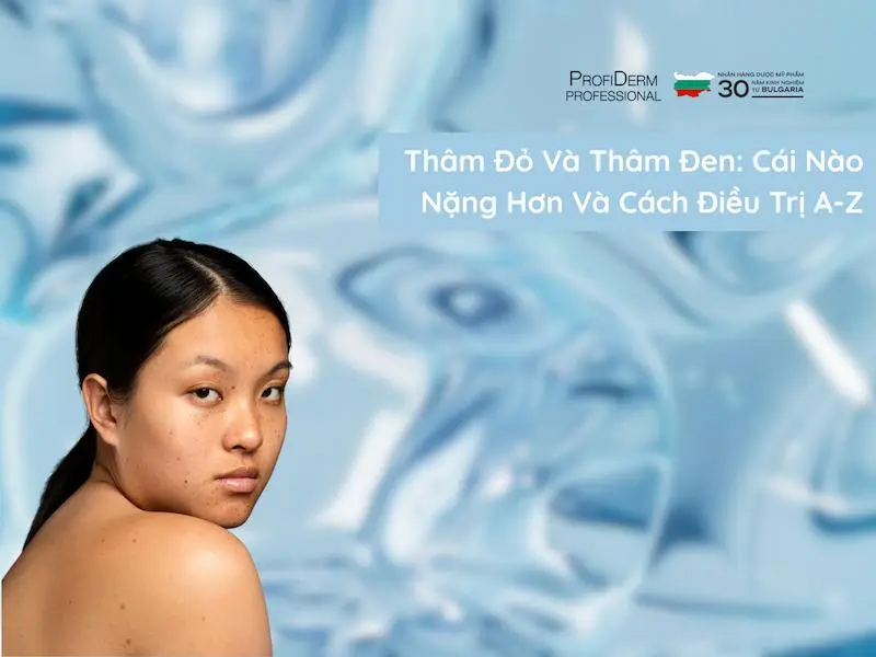 thâm đỏ và thâm đen cái nào nặng hơn thâm đỏ và thâm đen cái nào nặng hơn