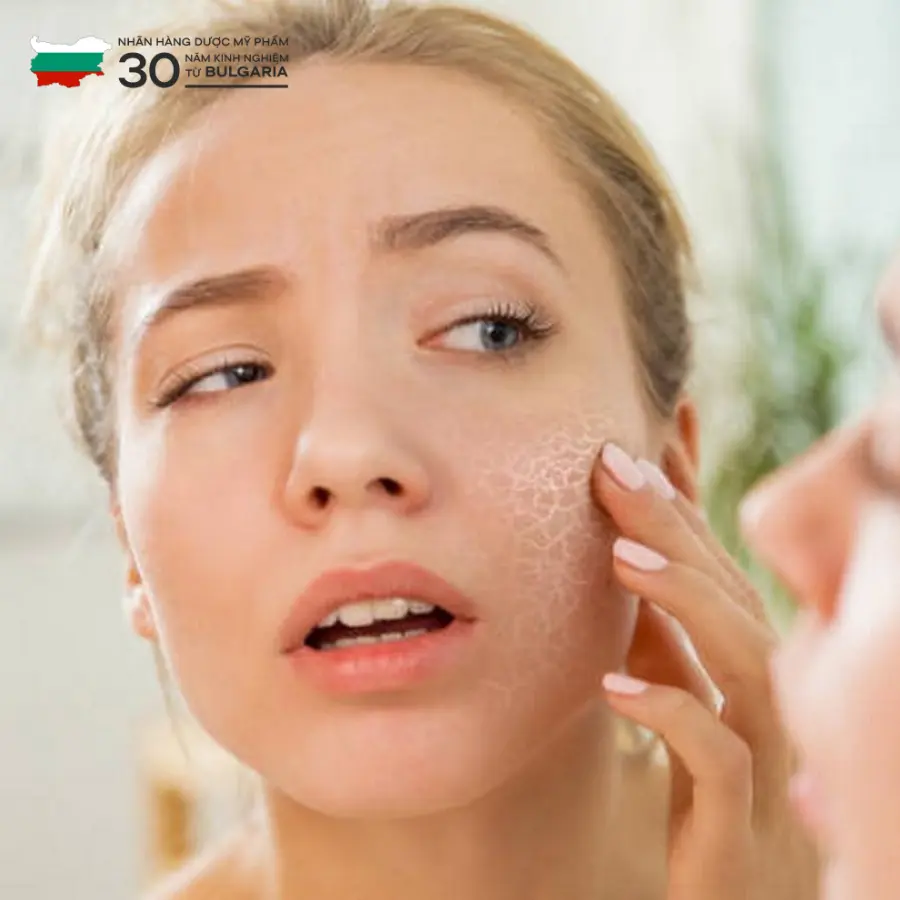 phục hồi da khô phục hồi da khô