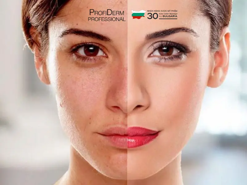 phục hồi da sau treatment phục hồi da sau treatment