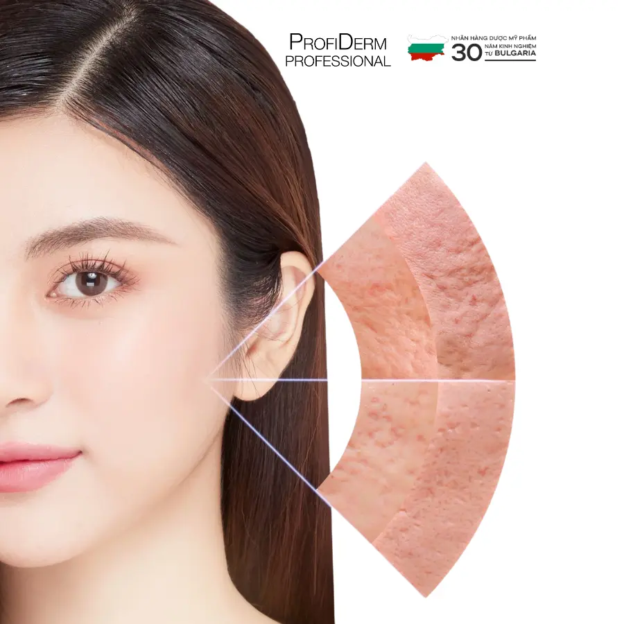 nguyên nhân giãn mao mạch ở mặt nguyên nhân giãn mao mạch ở mặt