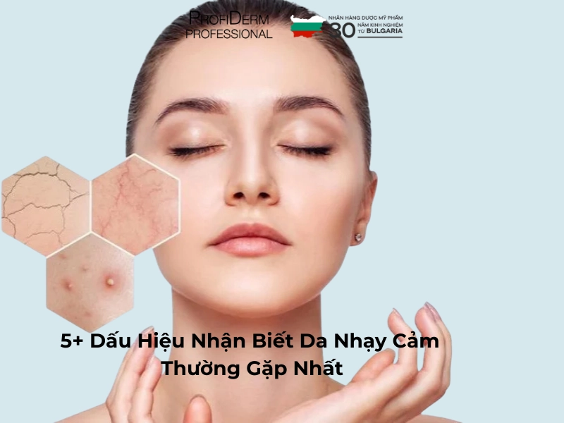 dấu hiệu nhận biết da nhạy cảm dấu hiệu nhận biết da nhạy cảm