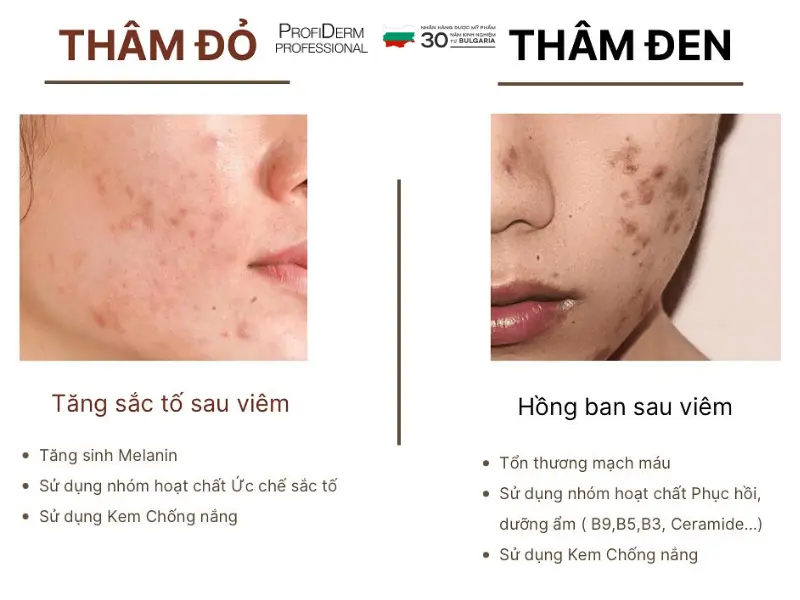 các hoạt chất trị thâm đỏ các hoạt chất trị thâm đỏ