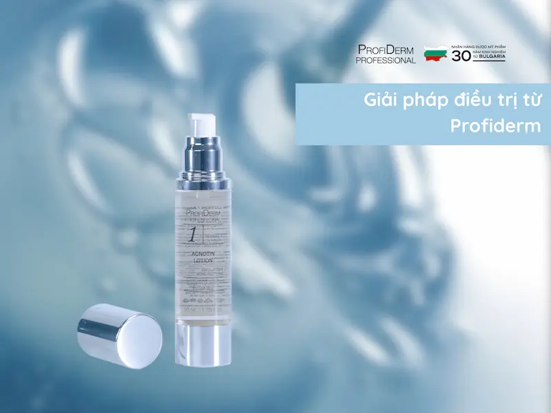 Acnotin Lotion - Lotion BHA - PHA hỗ trợ điều trị mụn, nám, đỏ da Acnotin Lotion - Lotion BHA - PHA hỗ trợ điều trị mụn, nám, đỏ da
