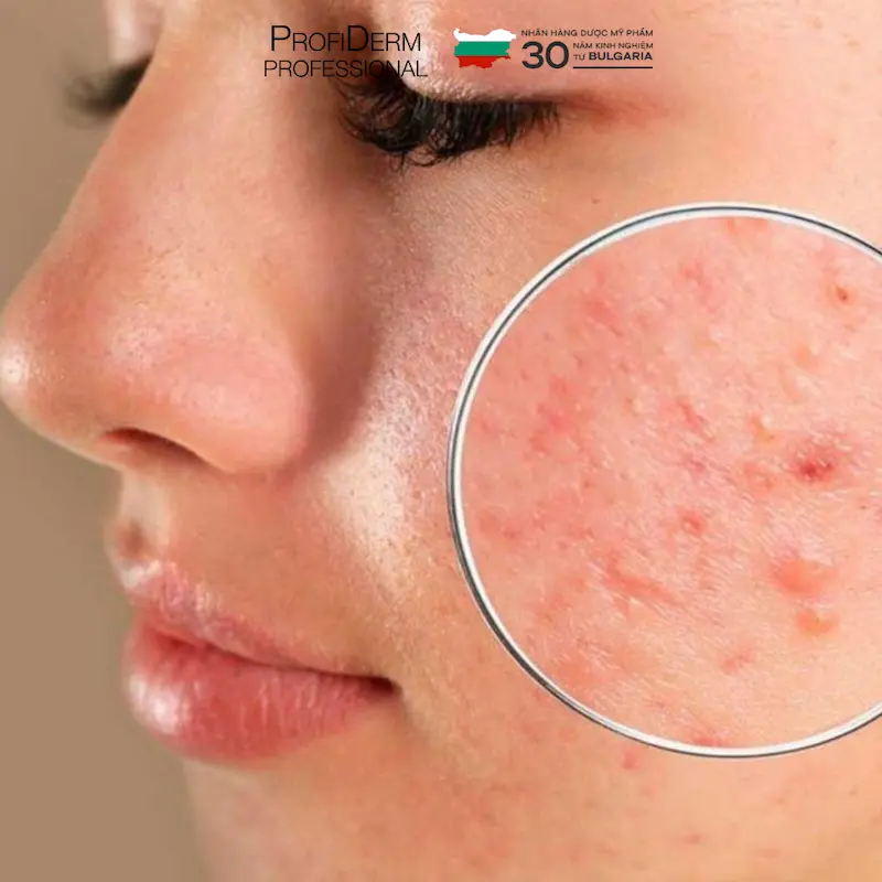chăm sóc da mặt bị hư tổn chăm sóc da mặt bị hư tổn