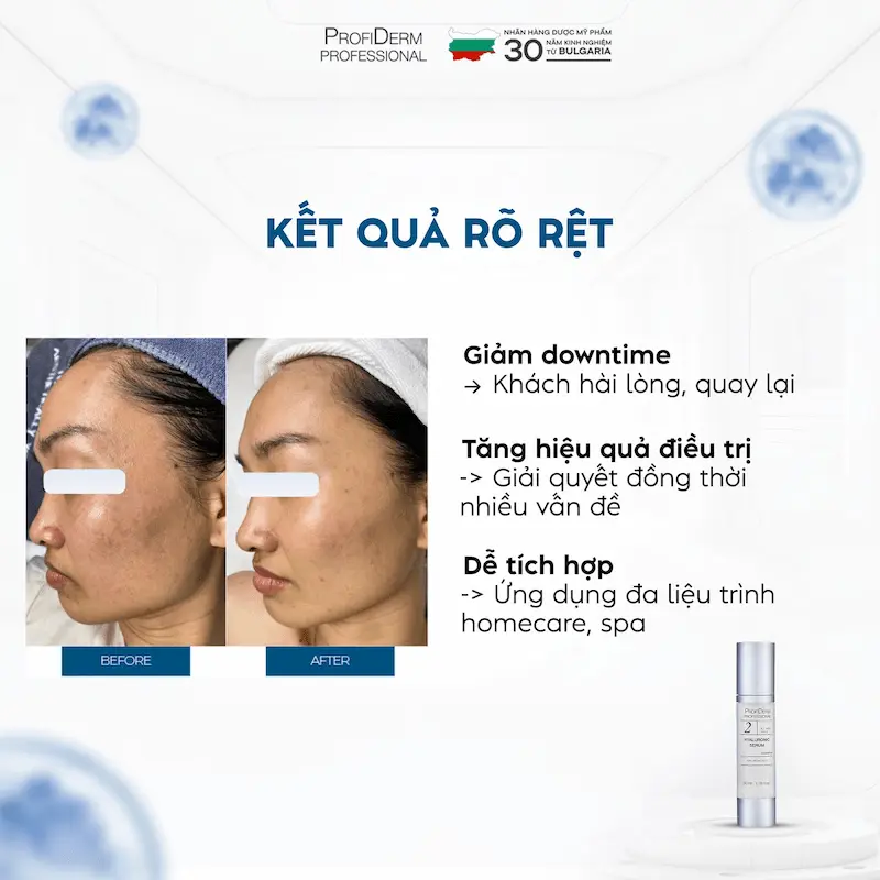 Các dòng sản phẩm nổi bật của Profiderm Các dòng sản phẩm nổi bật của Profiderm