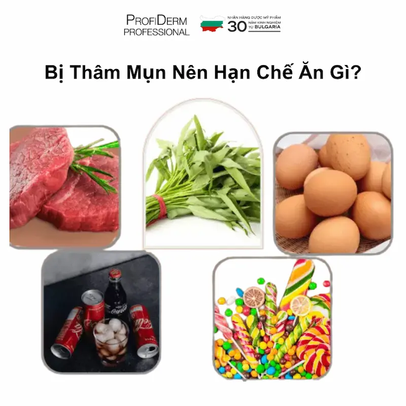 Bị Thâm Mụn Nên Hạn Chế Ăn Gì? Bị Thâm Mụn Nên Hạn Chế Ăn Gì?