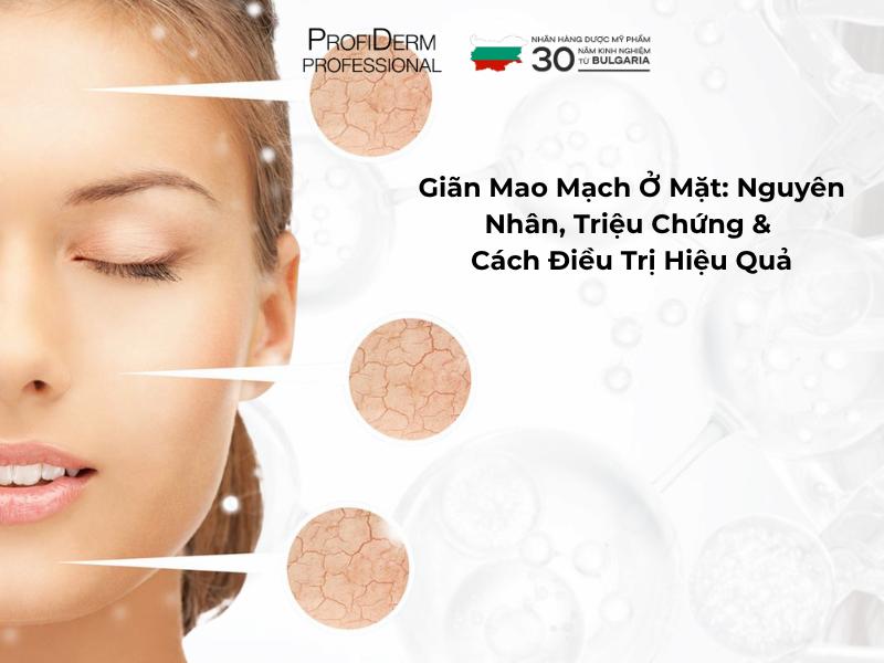Giãn Mao Mạch Ở Mặt: Nguyên Nhân, Triệu Chứng & Cách Điều Trị