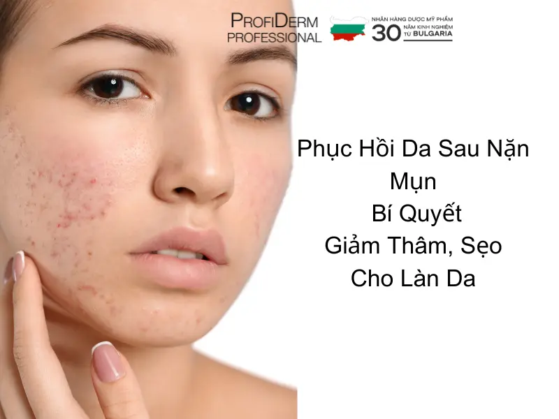 phục hồi da sau nặn mụn phục hồi da sau nặn mụn