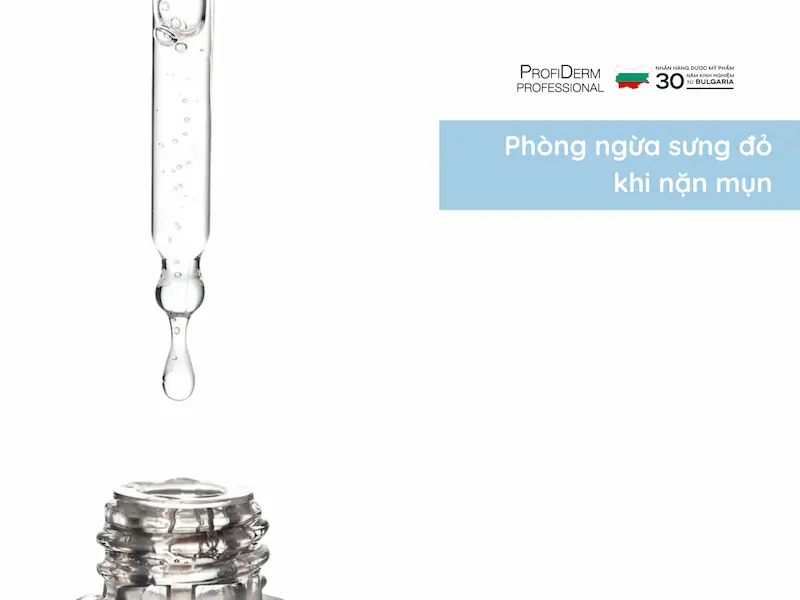 Phòng ngừa sưng đỏ khi nặn mụn Phòng ngừa sưng đỏ khi nặn mụn
