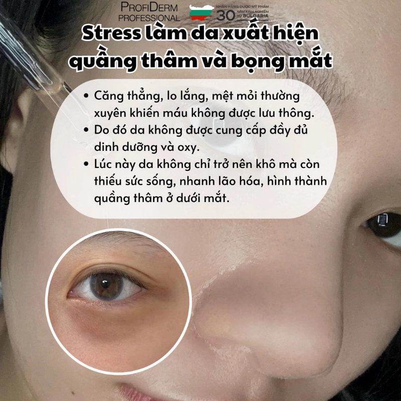Tác hại của stress đối với làn da Tác hại của stress đối với làn da