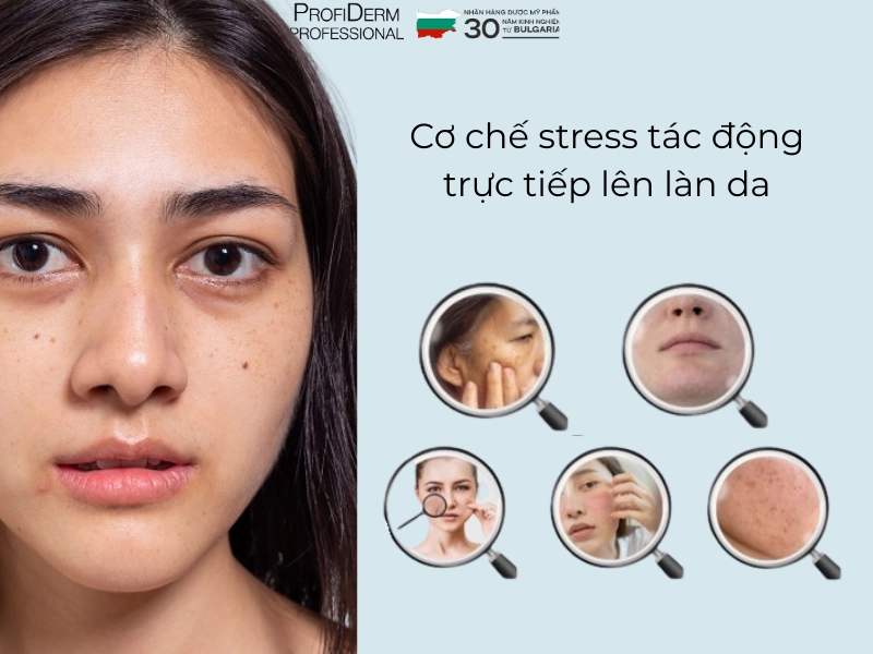 Tác hại của stress đối với làn da Tác hại của stress đối với làn da