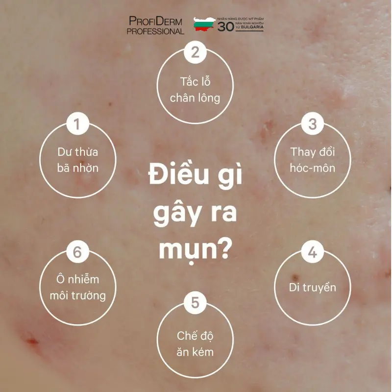 phục hồi da dầu mụn phục hồi da dầu mụn