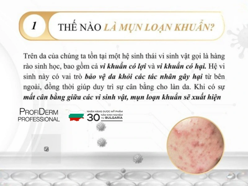 mụn loạn khuẩn mụn loạn khuẩn