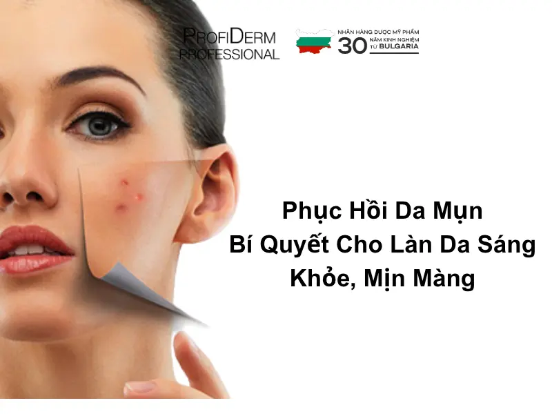 phục hồi da mụn