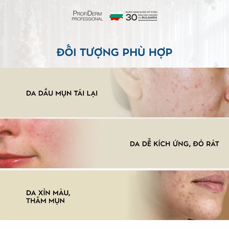 Profiderm Việt Nam – Giải pháp toàn diện cho làn da nhạy cảm mùa hè Profiderm Việt Nam – Giải pháp toàn diện cho làn da nhạy cảm mùa hè
