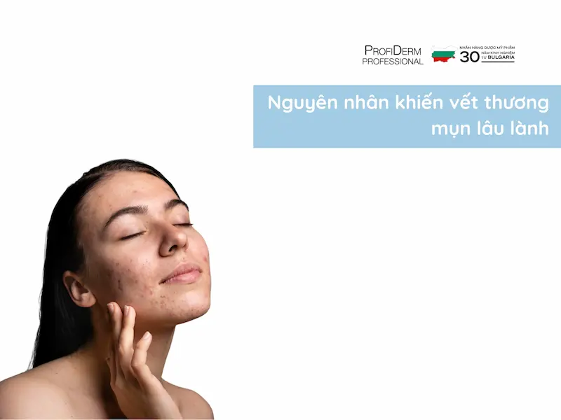 làm sao để vết thương mụn mau lành làm sao để vết thương mụn mau lành