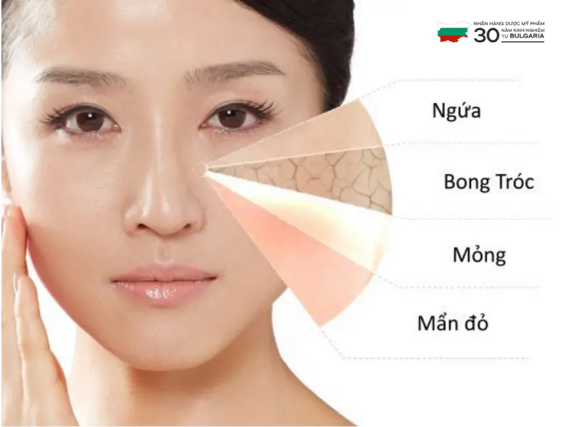 phục hồi da khô phục hồi da khô