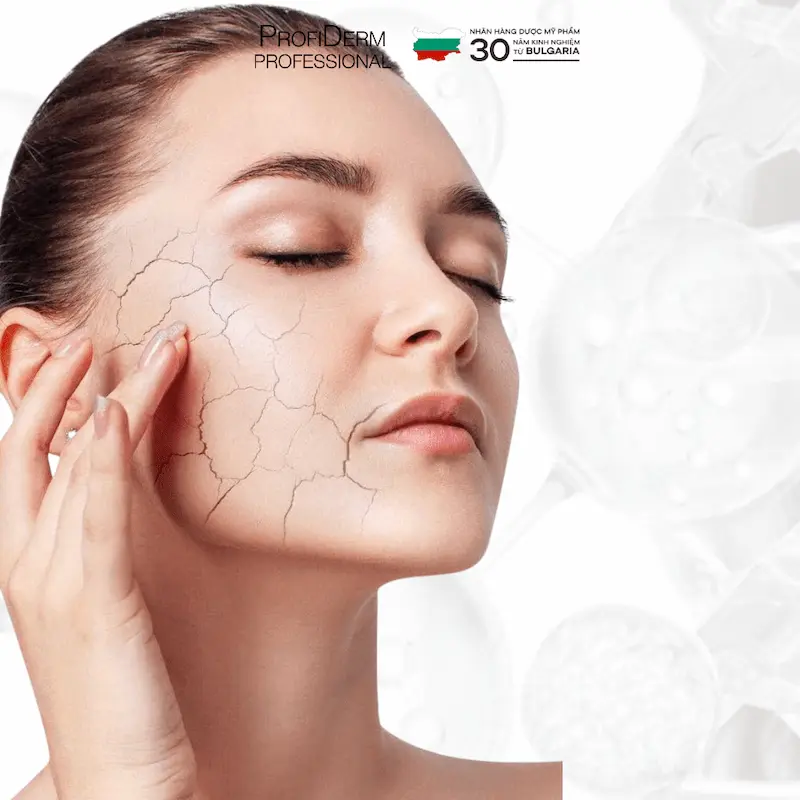 Các vị trí da dễ bị giãn mao mạch Các vị trí da dễ bị giãn mao mạch