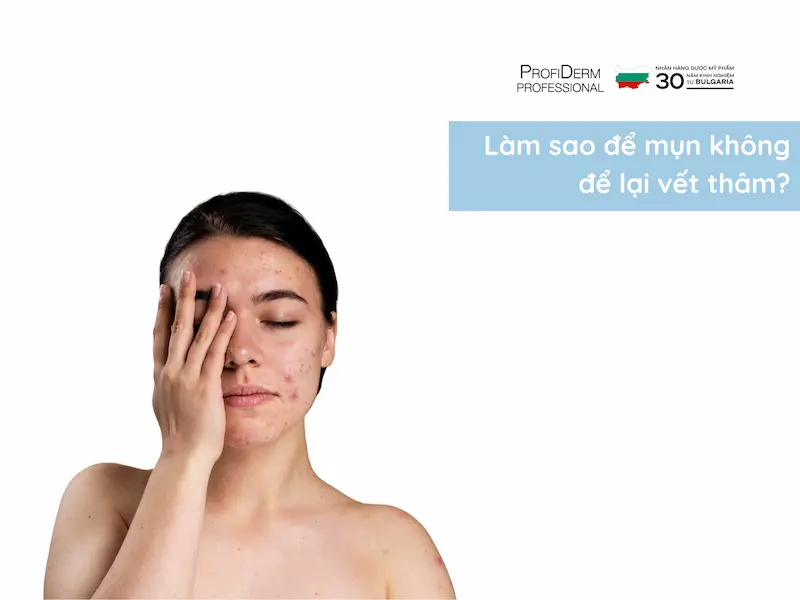 làm sao để mụn không để lại vết thâm làm sao để mụn không để lại vết thâm