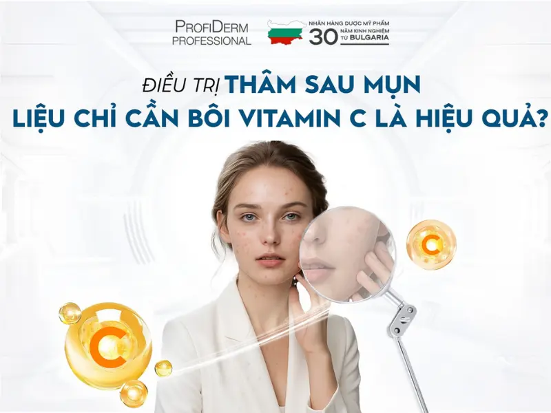 Cách chọn Vitamin C trị thâm hiệu quả Cách chọn Vitamin C trị thâm hiệu quả
