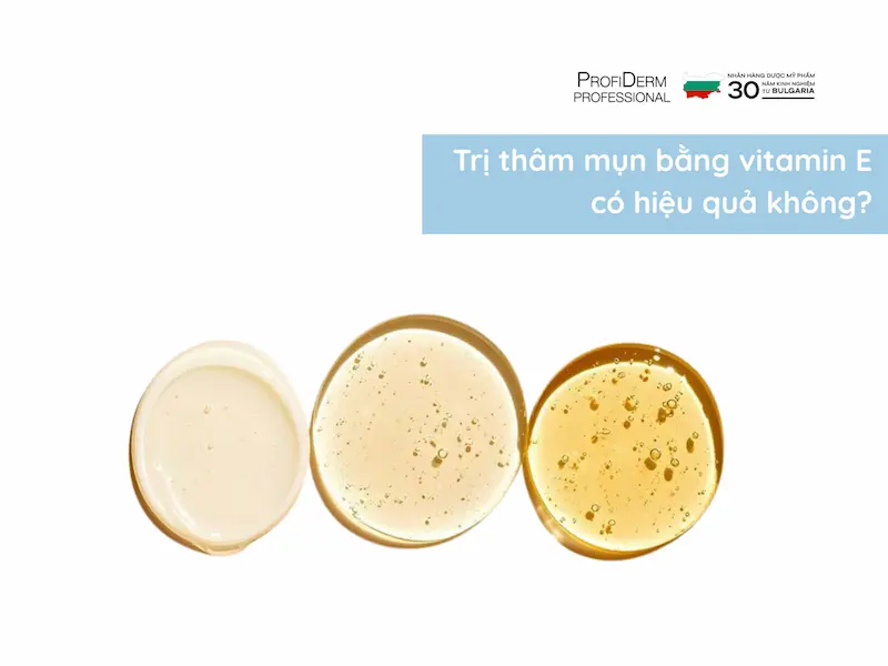 trị thâm mụn bằng vitamin e trị thâm mụn bằng vitamin e
