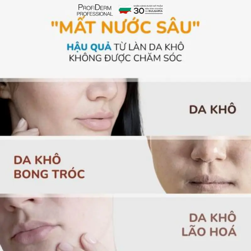 Hậu quả của việc mất nước sâu Hậu quả của việc mất nước sâu