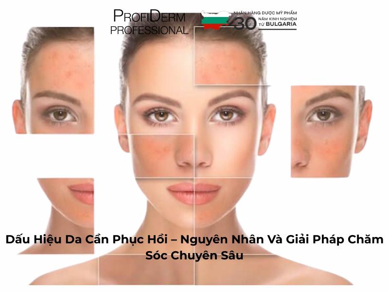 Dấu Hiệu Da Cần Phục Hồi – Nguyên Nhân Và Giải Pháp Phục Hồi