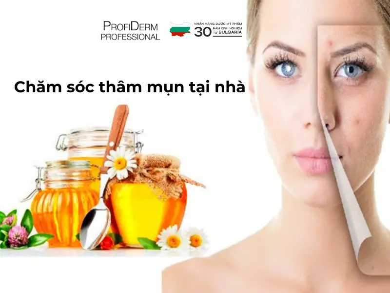 Giải pháp chuyên sâu giúp cải thiện vết thâm mụn Giải pháp chuyên sâu giúp cải thiện vết thâm mụn