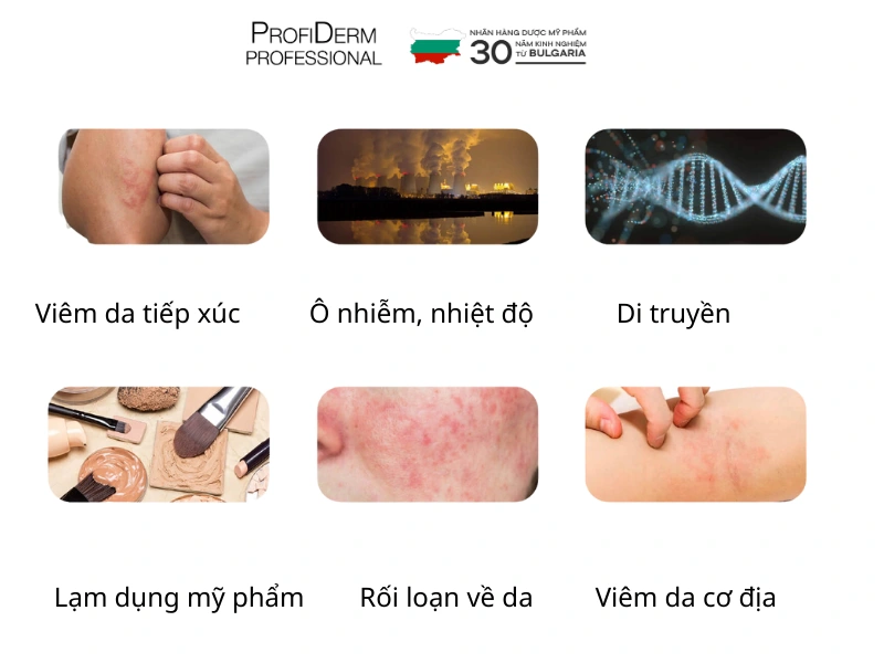 các bước chăm sóc da nhạy cảm các bước chăm sóc da nhạy cảm