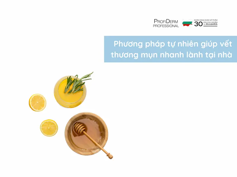Phương pháp tự nhiên giúp vết thương mụn nhanh lành tại nhà Phương pháp tự nhiên giúp vết thương mụn nhanh lành tại nhà