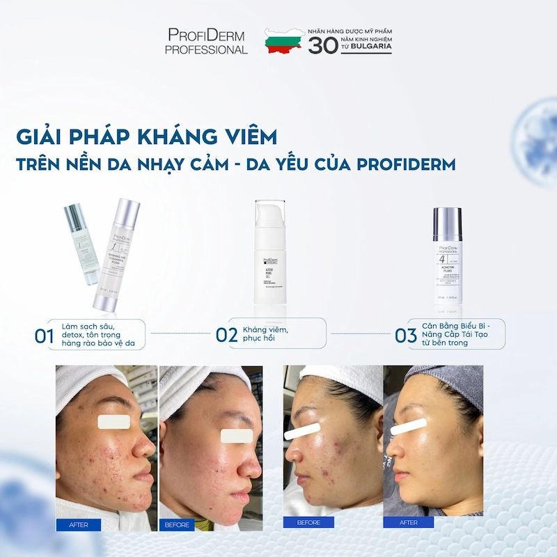 Lựa chọn tẩy trang dịu nhẹ Lựa chọn tẩy trang dịu nhẹ