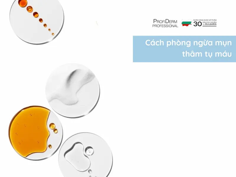 Cách phòng ngừa mụn thâm tụ máu Cách phòng ngừa mụn thâm tụ máu