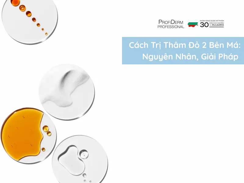 cách trị thâm đỏ 2 bên má cách trị thâm đỏ 2 bên má