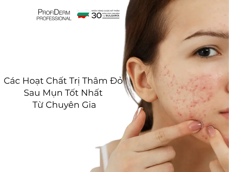 các hoạt chất trị thâm đỏ các hoạt chất trị thâm đỏ