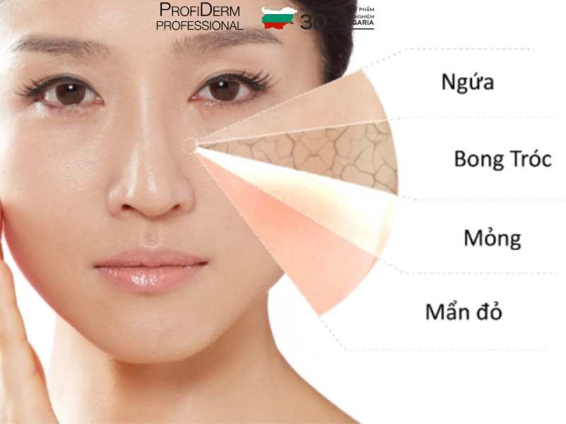 chăm sóc da nhạy cảm mùa hè chăm sóc da nhạy cảm mùa hè