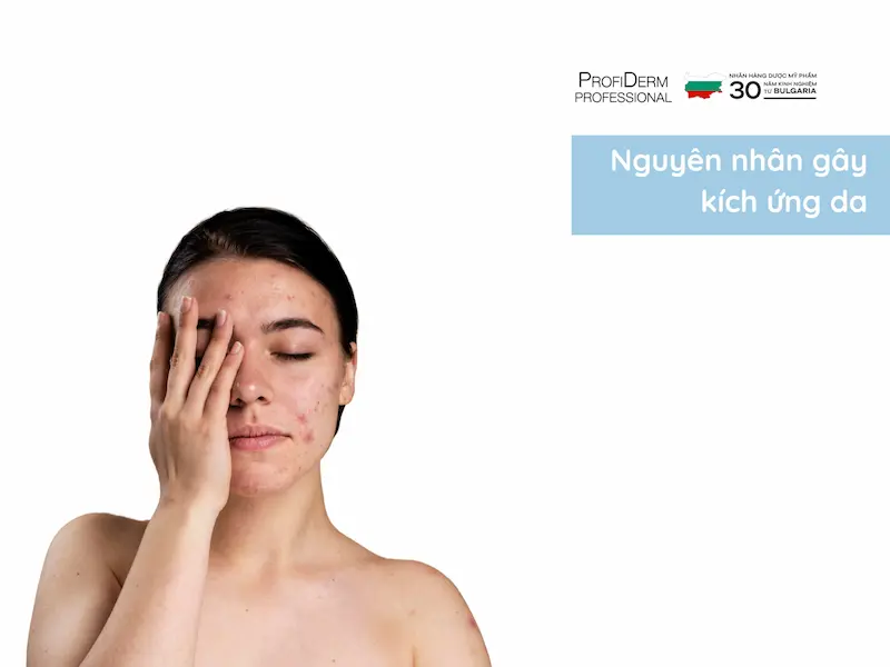 phục hồi da bị kích ứng phục hồi da bị kích ứng