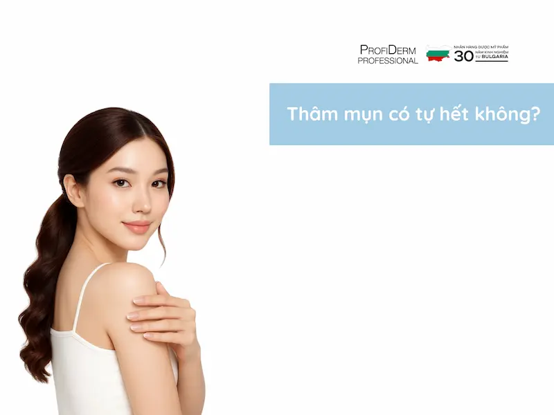 Thâm mụn có tự hết không? Thâm mụn có tự hết không?