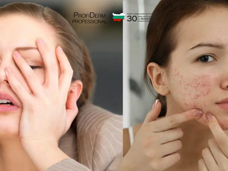 vitamin c có trị thâm không vitamin c có trị thâm không
