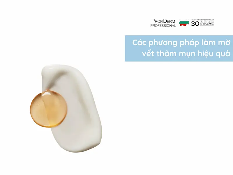 Các phương pháp làm mờ vết thâm mụn hiệu quả Các phương pháp làm mờ vết thâm mụn hiệu quả