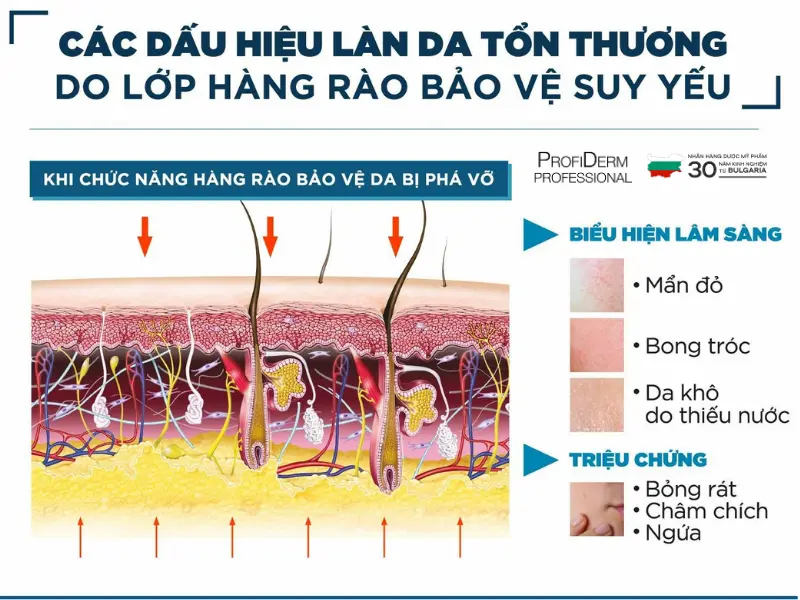 phục hồi da bị bào mòn phục hồi da bị bào mòn