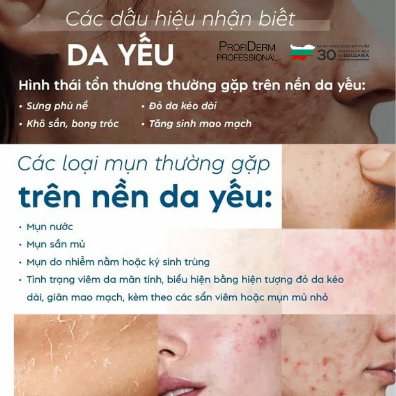 kem chống nắng cho da nhạy cảm kem chống nắng cho da nhạy cảm