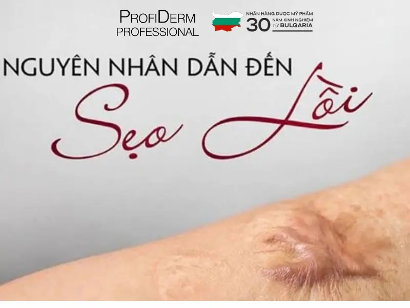 các loại thâm mụn các loại thâm mụn
