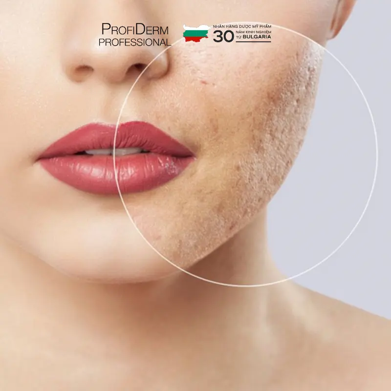 chăm sóc da mặt bị hư tổn chăm sóc da mặt bị hư tổn