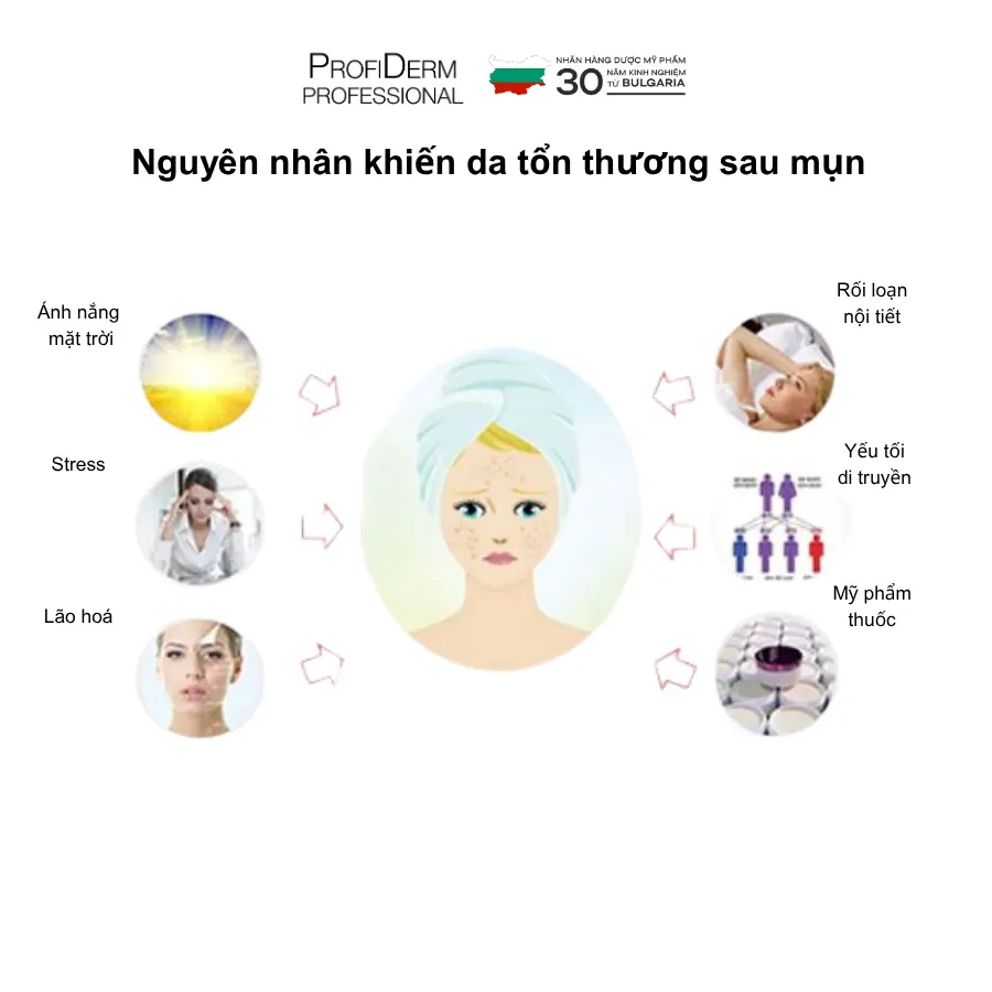 phục hồi da mụn phục hồi da mụn