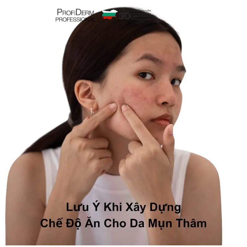 Lưu Ý Khi Xây Dựng Chế Độ Ăn Cho Da Mụn Thâm Lưu Ý Khi Xây Dựng Chế Độ Ăn Cho Da Mụn Thâm