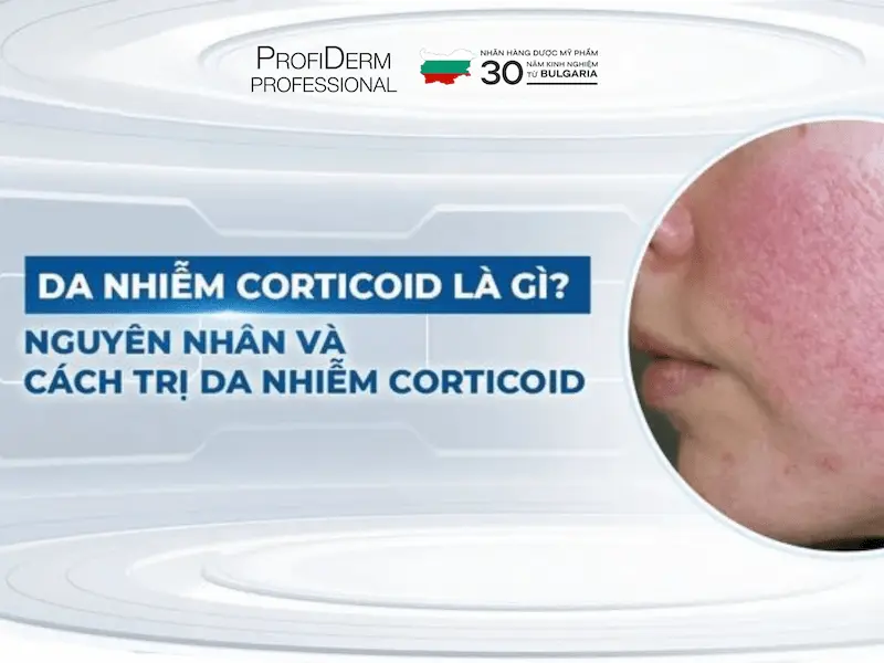 phục hồi da nhiễm corticoid phục hồi da nhiễm corticoid