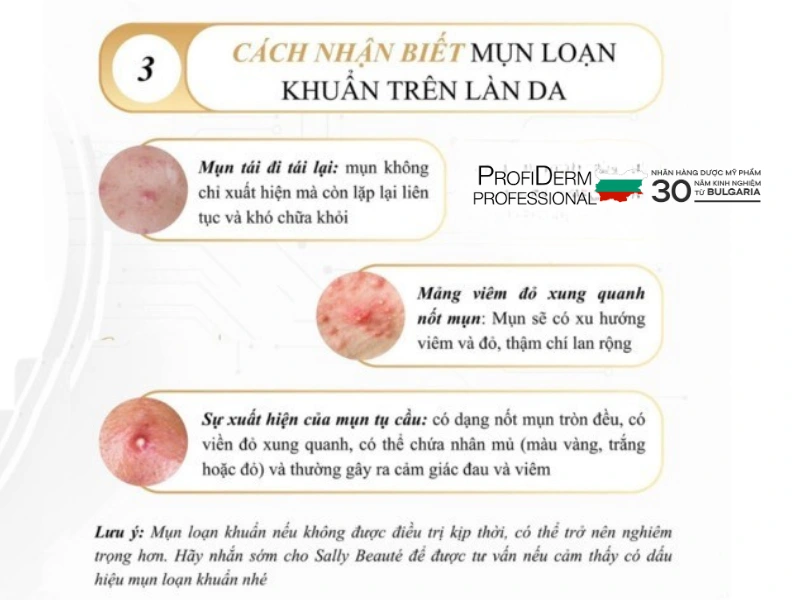 mụn loạn khuẩn mụn loạn khuẩn