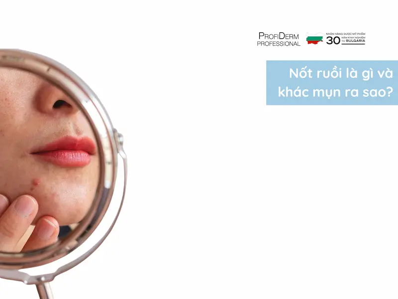 mụn để lâu không nặn có thành nốt ruồi không mụn để lâu không nặn có thành nốt ruồi không