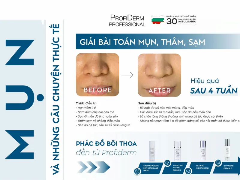 vitamin c có trị thâm không vitamin c có trị thâm không
